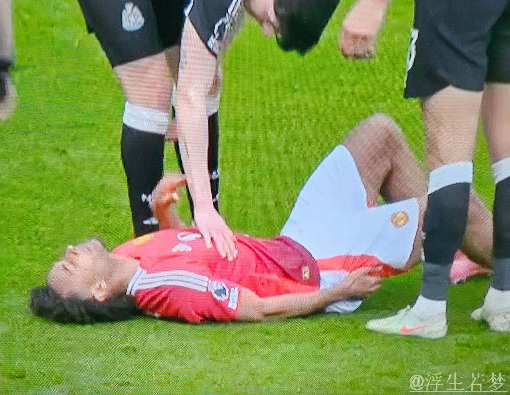 齐尔克泽伤缺至少半月，曼联或有6人缺席战里昂，阿马德已重返训练！